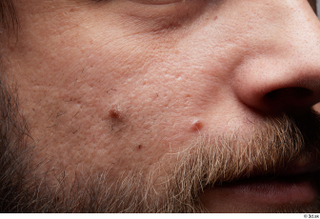 HD Face Skin Arron Cooper cheek face nose skin pores…